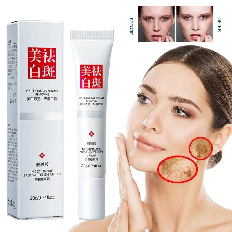 Fade and Improve Freckles Blac - Healing Wellness recensie en prijs